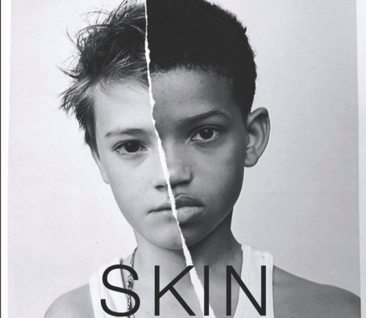 JCiak – Skin, l’odio sulla pelle